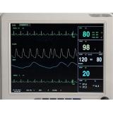 12-inch ICU CCU 6-Parameter Patient Monitor 9000A