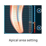 DENJOY Dental Touch-Screen Color Display Apex Locator Root Canal Endodontic