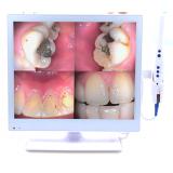 17inch Wired Intraoral Cameras Wireless Dental Camera Monitor