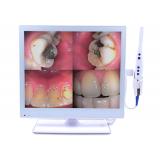 17inch Wired Intraoral Cameras Wireless Dental Camera Monitor