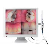 19 inch LCD Monitor With Intra Oral Camera 