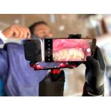 Dental Photography Flash Light Mobile Phone Stand Oral Filling Smartphone Holder