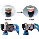 Dental Photography Flash Light Mobile Phone Stand Oral Filling Smartphone Holder