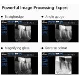 Eighteeth Nanopix1 Dental Rvg Sensor