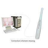 Dental USB Intraoral Camera 1080P 30FPS High-Definition 