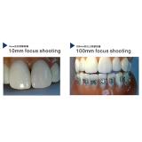 Dental Wireless USB Intraoral Camera 680II