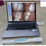 Dental USB Wireless Intraoral Camera Sony CCD 2.0 Mega Pixels PC Connection Intra Oral Camera