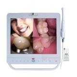 15inch LCD Monitor Wired Intraoral Camera