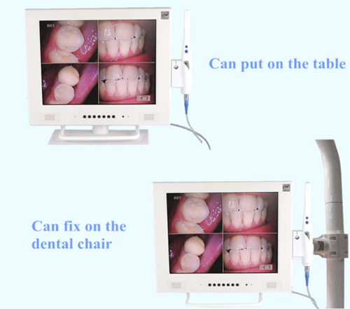 19 inch LCD Monitor With Intra Oral Camera 