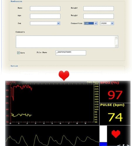 CONTEC TFT Finger Pulse Oximeter CMS60C